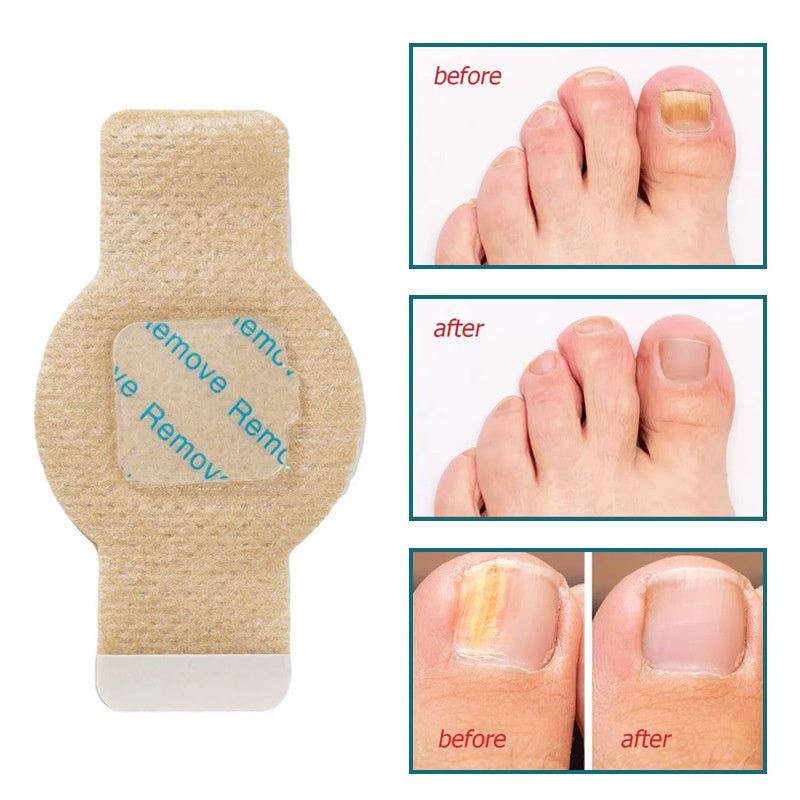 Fungal Nail Patch Toe Nail Protector Disguise Nail Cover Anti-Bacterial Infection Nail Foot Care Finger Protective Patch